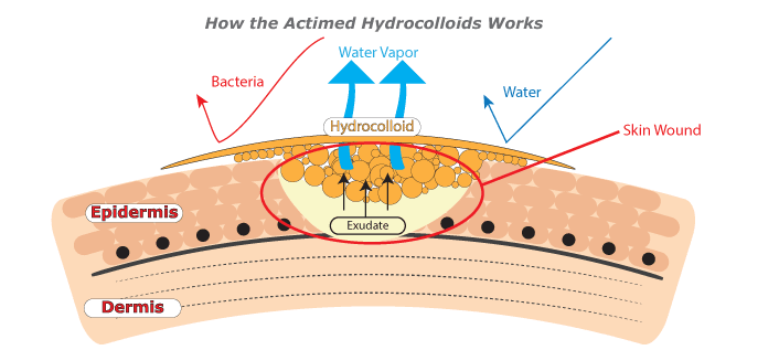 ไฮโดรคอลลอยด์, Hydrocolloids