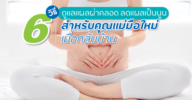 แผลผ่าคลอด